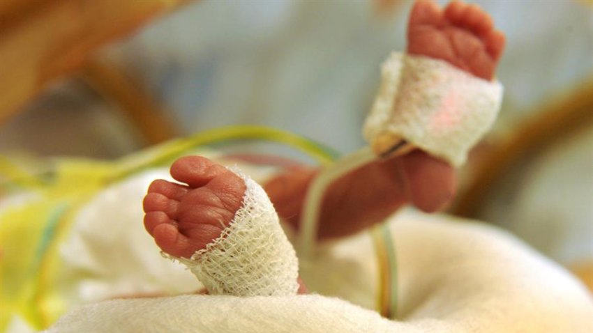 Estudio arroja datos sobre si la epidural tendría relación o no con el autismo
