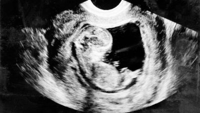Doctores de Arizona podrían ir a practicar abortos en California, según nueva ley