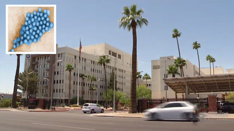 virus-que-afecta-a-residentes-de-arizona