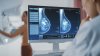Ofrecen mamografías gratis en feria de salud en Phoenix