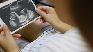 Defensores del derecho al aborto en Arizona demandan para revocar antigua prohibición
