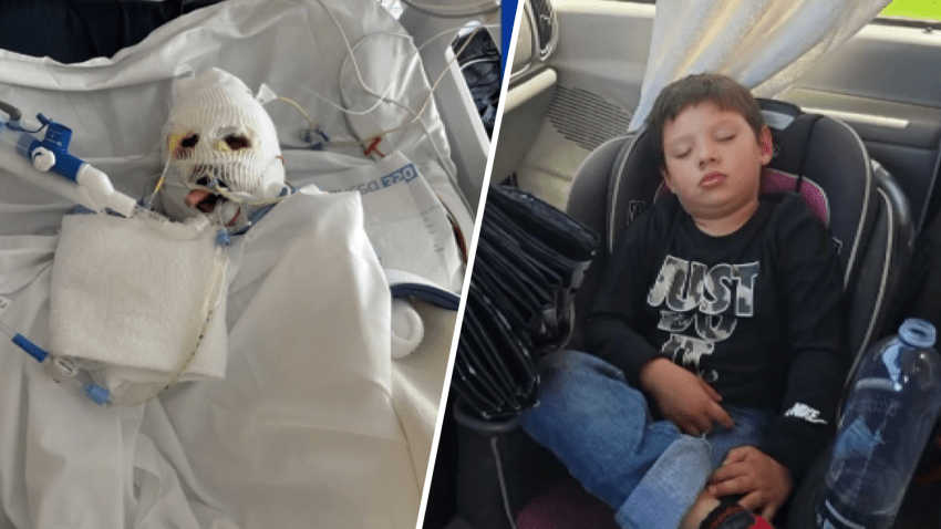 Left: 5-year-old Nathaniel Rodriguez is treated for burn injuries at UCI Medical Center. Right: An undated image of Rodriguez prior to the crash.