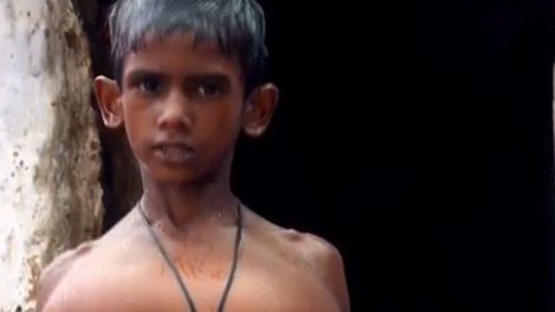Video: El horror del niño de manos gigantes