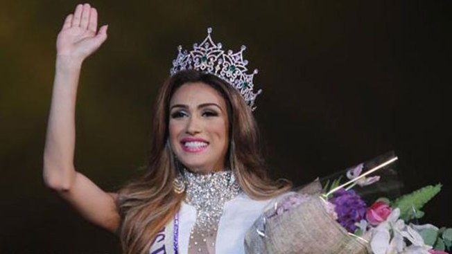 Este bellezón... ¿es hombre o mujer?
