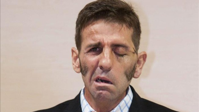 Torero quiere volver al ruedo