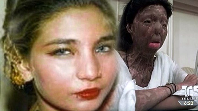 El rostro de la muerte